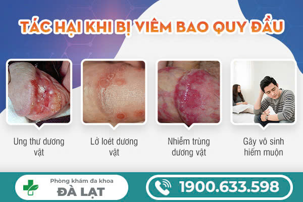 Block Image