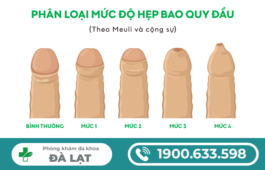 Bao quy đầu không lột được là do đâu?