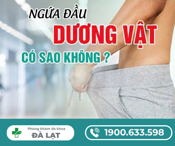 NGỨA ĐẦU DƯƠNG VẬT CÓ SAO KHÔNG