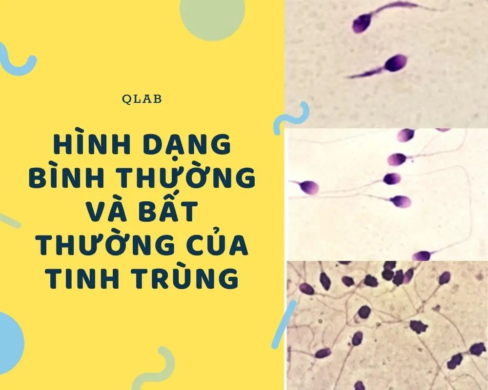 CÁCH CHỮA BỆNH TINH TRÙNG YẾU TẠI PHÒNG KHÁM ĐA KHOA ĐÀ LẠT 