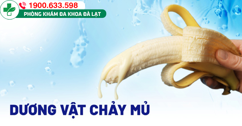 PHƯƠNG PHÁP CHỮA DƯƠNG VẬT CHẢY MỦ AN TOÀN VÀ HIỆU QUẢ