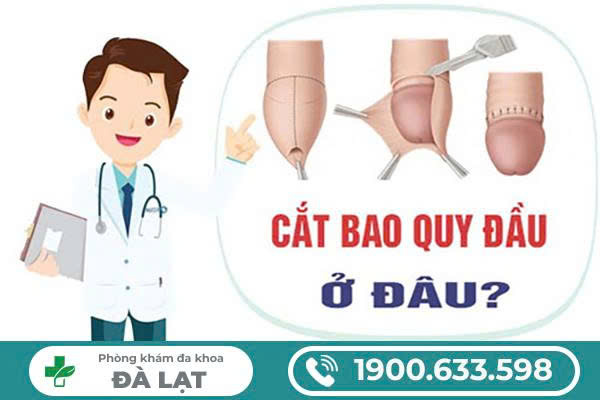 QUY TRÌNH CẮT BAO QUY ĐẦU CHUẨN Y TẾ TẠI PHÒNG KHÁM UY TÍN