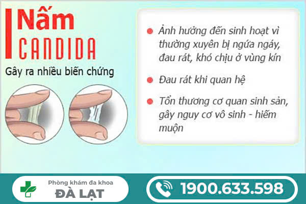 TÌM HIỂU VỀ NẤM SINH DỤC Ở NAM VÀ NỮ 