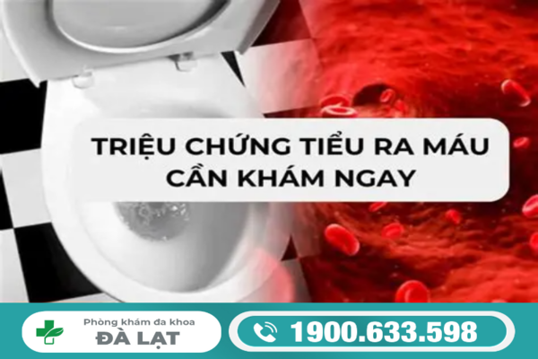 NGUYÊN NHÂN ĐI TIỂU RA MÁU Ở NAM GIỚI 