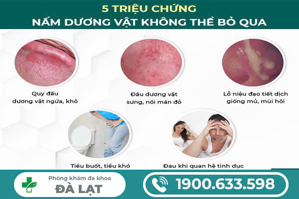 DẤU HIỆU NẤM DƯƠNG: NHẬN BIẾT ĐỂ ĐIỀU TRỊ SỚM
