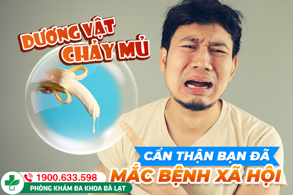 GIỌT MỦ BAN MAI LÀ GÌ? DẤU HIỆU VÀ CÁCH ĐIỀU TRỊ HIỆU QUẢ