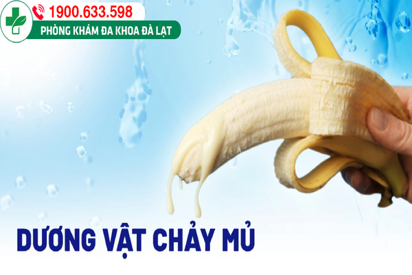 BAO QUY ĐẦU CHẢY MỦ: NGUYÊN NHÂN VÀ CÁCH ĐIỀU TRỊ HIỆU QUẢ