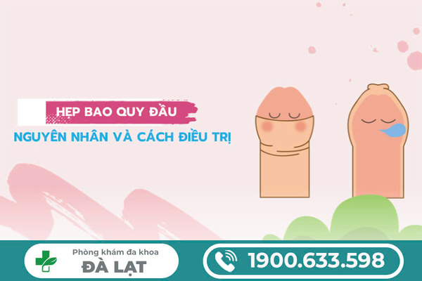 QUY TRÌNH CẮT HẸP BAO QUY ĐẦU CHI TIẾT TỪ A - Z