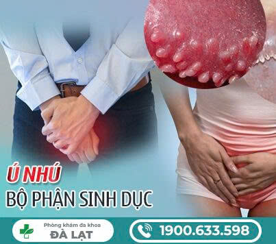 CÁC BIỂU HIỆN CỦA NẤM SINH DỤC Ở NAM GIỚI 