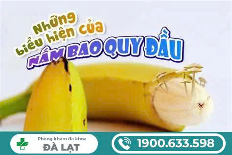 HÌNH ẢNH NẤM BAO QUY ĐẦU Ở NAM GIỚI: DẤU HIỆU NHẬN BIẾT SỚM