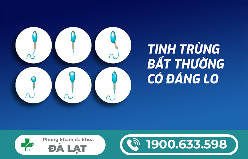 TẠI SAO NAM GIỚI BỊ TINH TRÙNG VÓN CỤC? GIẢI ĐÁP CỦA BÁC SĨ