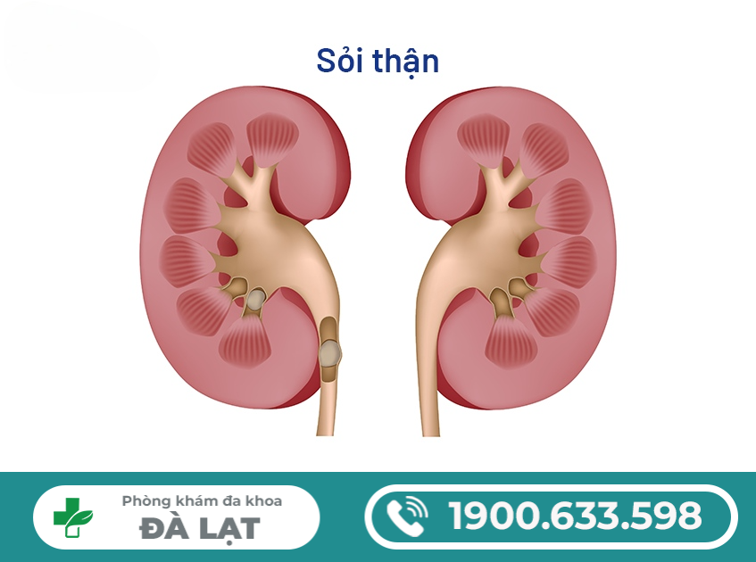 PHƯƠNG PHÁP ĐIỀU TRỊ VIÊM BÀNG QUANG Ở NAM GIỚI HIỆU QUẢ HIỆN NAY 