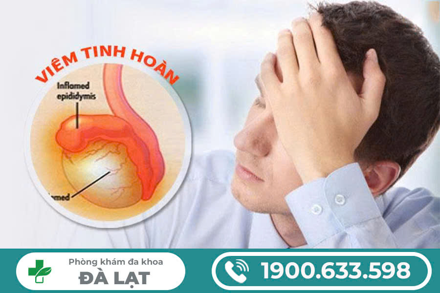 HỎI ĐÁP BỆNH VIÊM TINH HOÀN: NHỮNG ĐIỀU NAM GIỚI CẦN BIẾT 