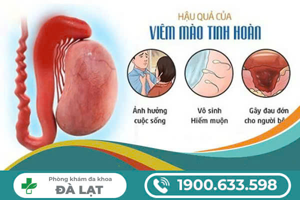 NAM GIỚI BỊ VIÊM TINH HOÀN DO ĐÂU? GIẢI ĐÁP CỦA BÁC SĨ CHUYÊN KHOA\