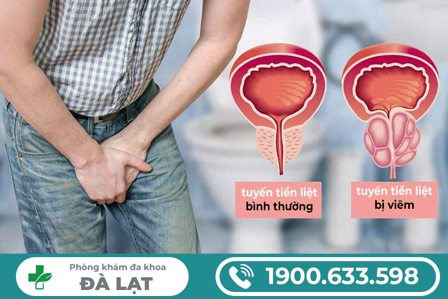 PHƯƠNG PHÁP ĐIỀU TRỊ VIÊM TUYẾN TIỀN LIỆT AN TOÀN VÀ HIỆU QUẢ HIỆN NAY