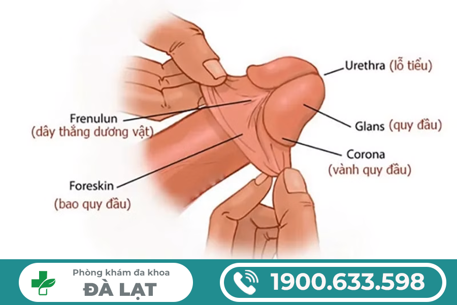 ĐỨT DÂY HÃM BAO QUY ĐẦU: NGUYÊN NHÂN, BIỂU HIỆN VÀ BIẾN CHỨNG NGUY HIỂM 