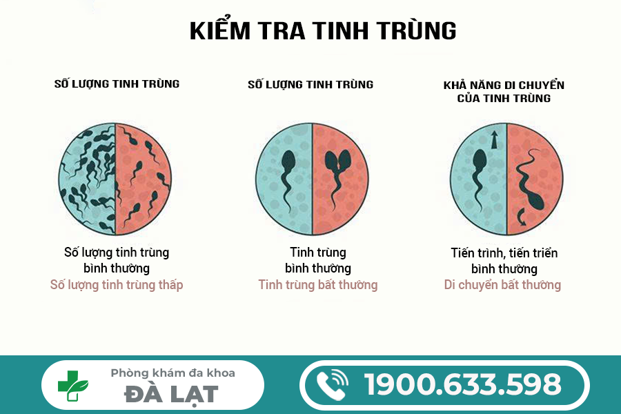 XÉT NGHIỆM KIỂM TRA TINH TRÙNG Ở ĐÂU CHÍNH XÁC VÀ UY TÍN HIỆN NAY?