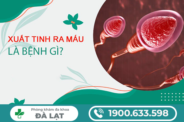 NAM GIỚI XUẤT TINH RA MÁU DO ĐÂU? BÁC SĨ CHUYÊN KHOA GIẢI ĐÁP