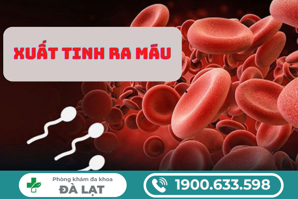 PHƯƠNG PHÁP ĐIỀU TRỊ XUẤT TINH RA MÁU HIỆU QUẢ HIỆN NAY 