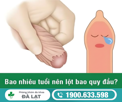 LỘT BAO QUY ĐẦU HẾT BAO NHIÊU? GIẢI ĐÁP CỦA BÁC SĨ