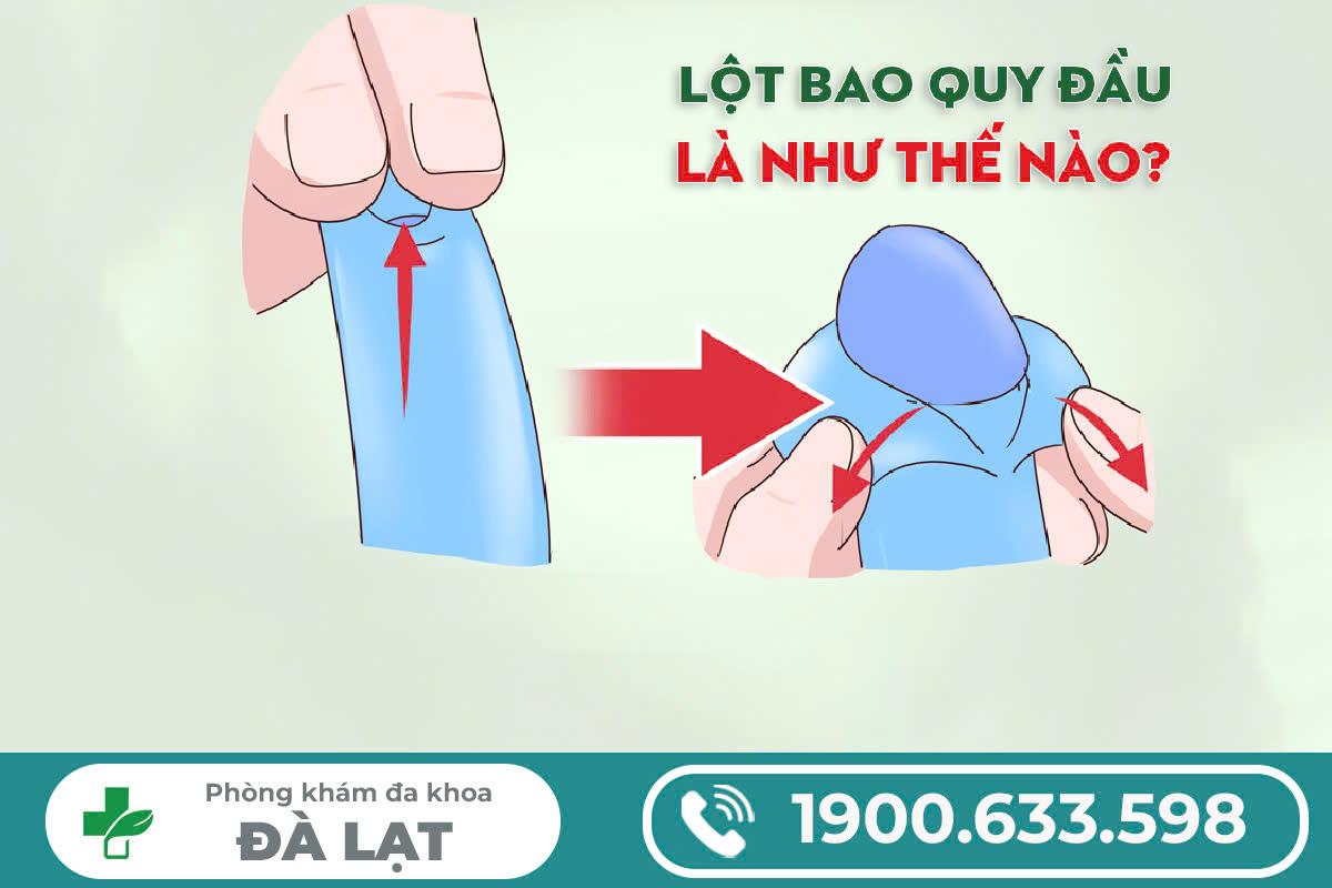 CÁC LỢI ÍCH CỦA LỘT BAO QUY ĐẦU NAM GIỚI NÊN BIẾT ĐỂ BẢO VỆ SỨC KHỎE 