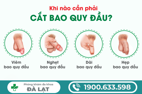 VÌ SAO KHÔNG LỘT BAO QUY ĐẦU XUỐNG ĐƯỢC? NGUYÊN NHÂN VÀ CÁCH ĐIỀU TRỊ