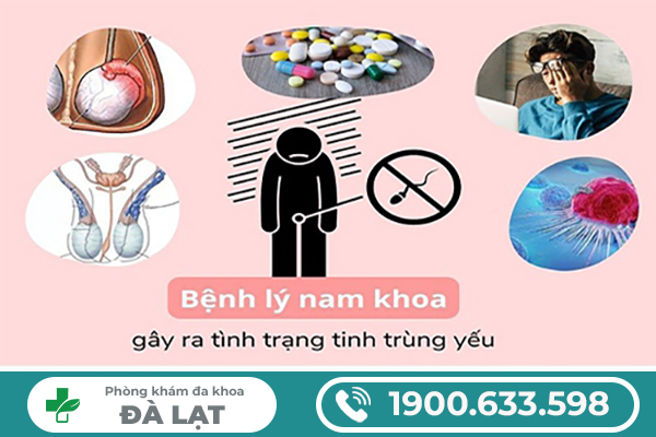 CÁC NGUYÊN NHÂN KHIẾN TINH TRÙNG YẾU Ở NAM GIỚI