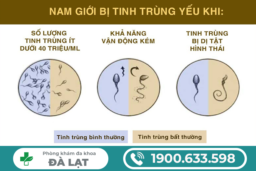 PHƯƠNG PHÁP ĐIỀU TRỊ TINH TRÙNG YẾU Ở NAM GIỚI HIỆU QUẢ HIỆN NAY 