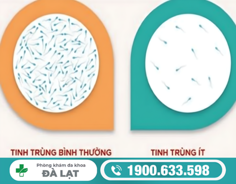 TINH TRÙNG ÍT CÓ SAO KHÔNG? BÁC SĨ GIẢI ĐÁP CHI TIẾT CHO NAM GIỚI 
