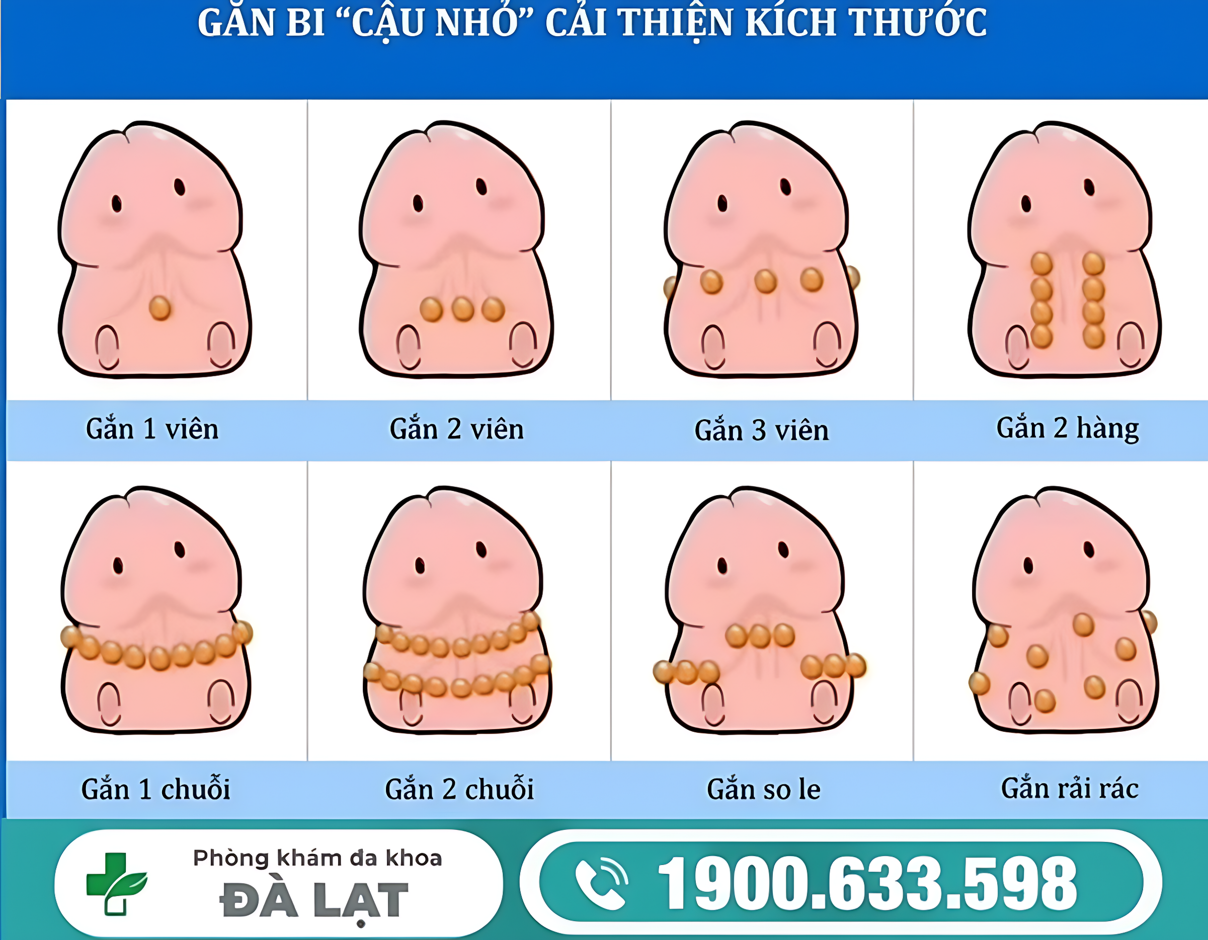 CÁCH GẮN BI DƯƠNG VẬT AN TOÀN NAM GIỚI CẦN BIẾT TRƯỚC KHI THỰC HIỆN