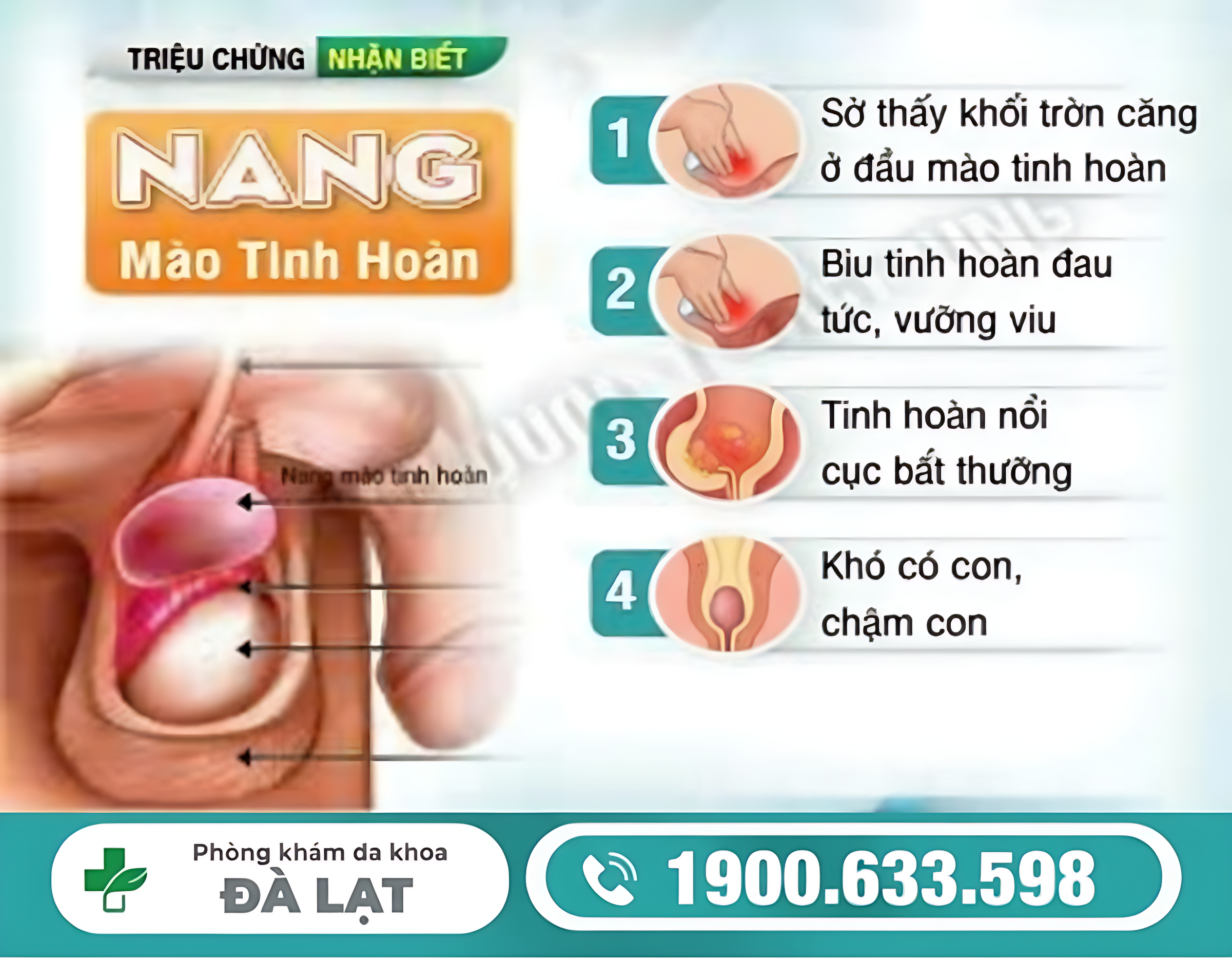 BỆNH NANG THỪNG TINH HOÀN: BIỂU HIỆN, NGUYÊN NHÂN VÀ CÁCH ĐIỀU TRỊ HIỆU QUẢ