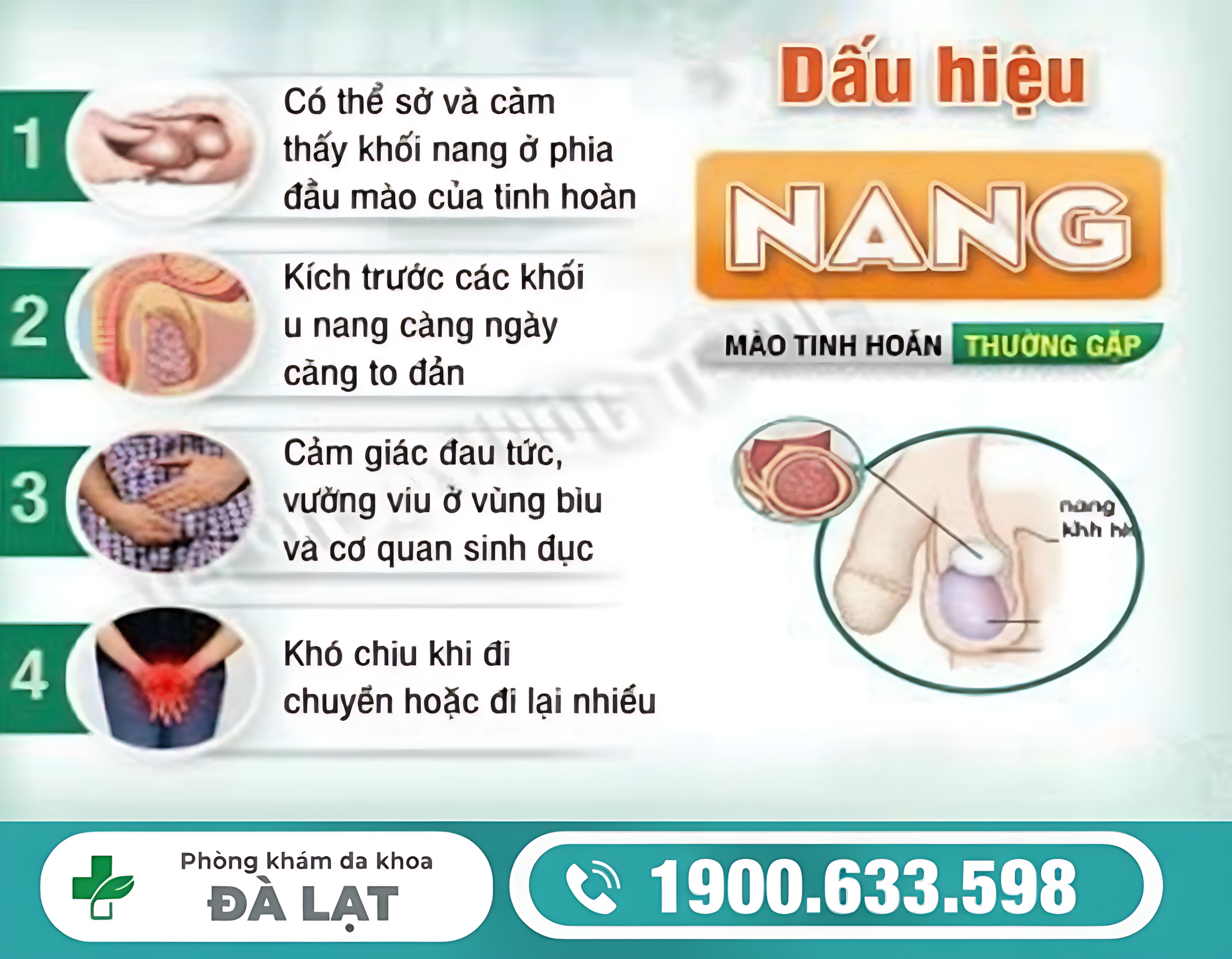 NGUYÊN NHÂN GÂY NANG MÀO TINH HOÀN PHẢI NAM GIỚI CẦN BIẾT