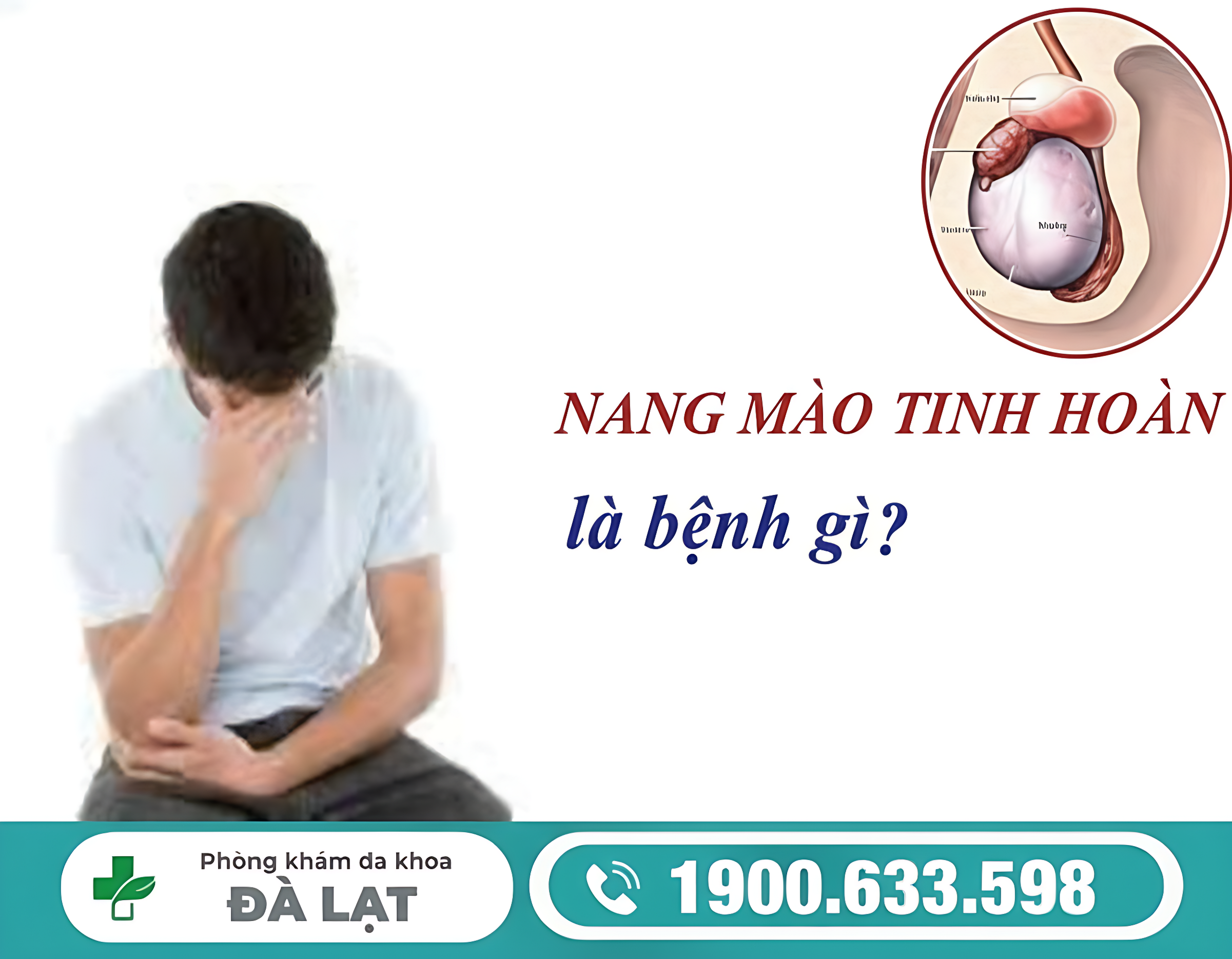 NANG MÀO TINH HOÀN TRÁI CÓ NGUY HIỂM KHÔNG? KHI NÀO CẦN ĐIỀU TRỊ