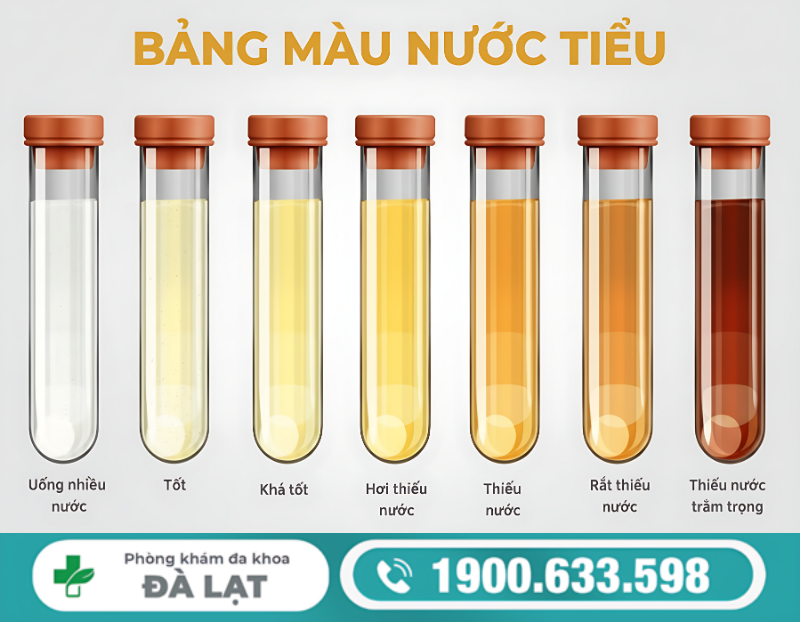 NƯỚC TIỂU MÀU CAM Ở MẸ BẦU DO ĐÂU? KHI NÀO CẦN ĐI KHÁM BÁC SỸ