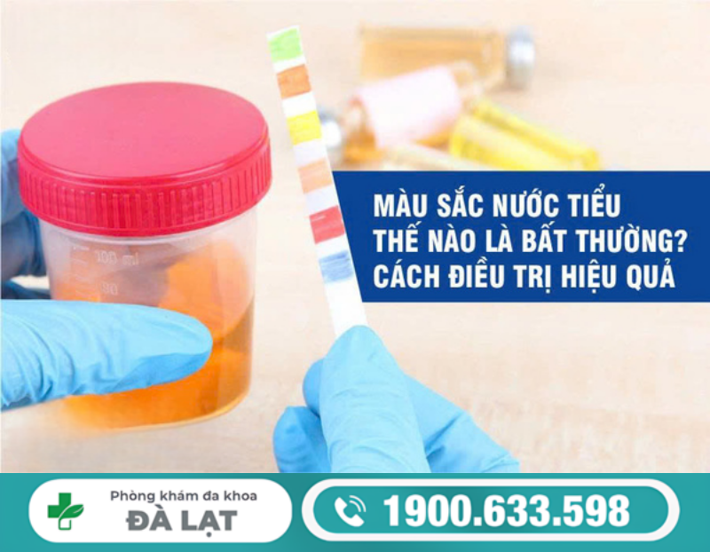NGUYÊN NHÂN KHIẾN NƯỚC TIỂU TRẮNG ĐỤC Ở BÀ BẦU VÀ CÁCH ĐIỀU TRỊ HIỆU QUẢ 