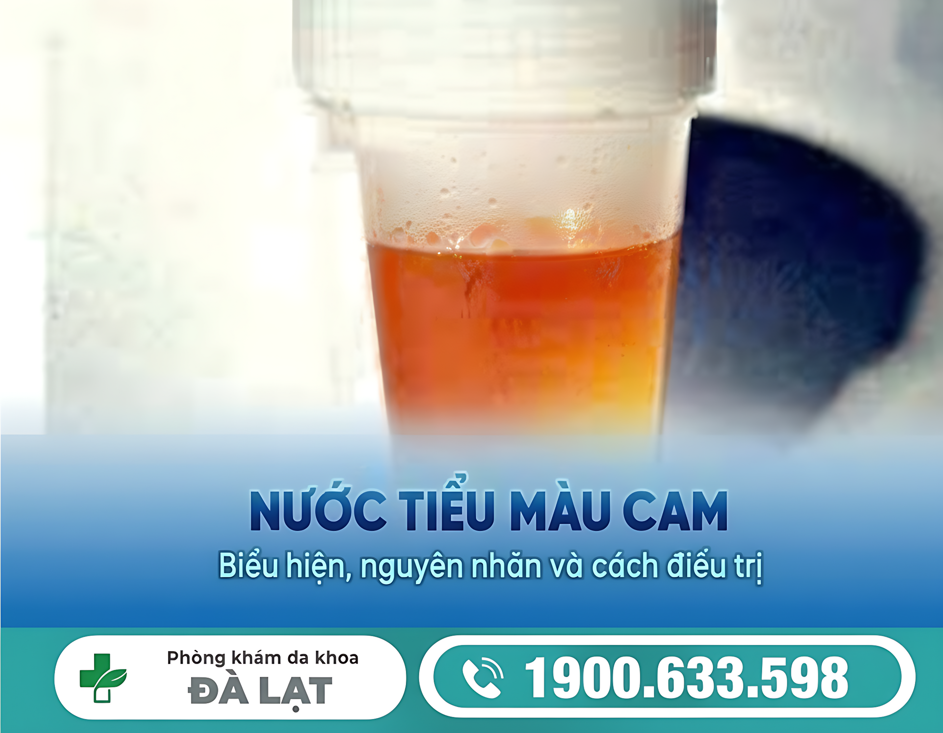 NƯỚC TIỂU MÀU CAM ĐẬM Ở NỮ GIỚI: NGUYÊN NHÂN VÀ CÁCH ĐIỀU TRỊ HIỆU QUẢ 