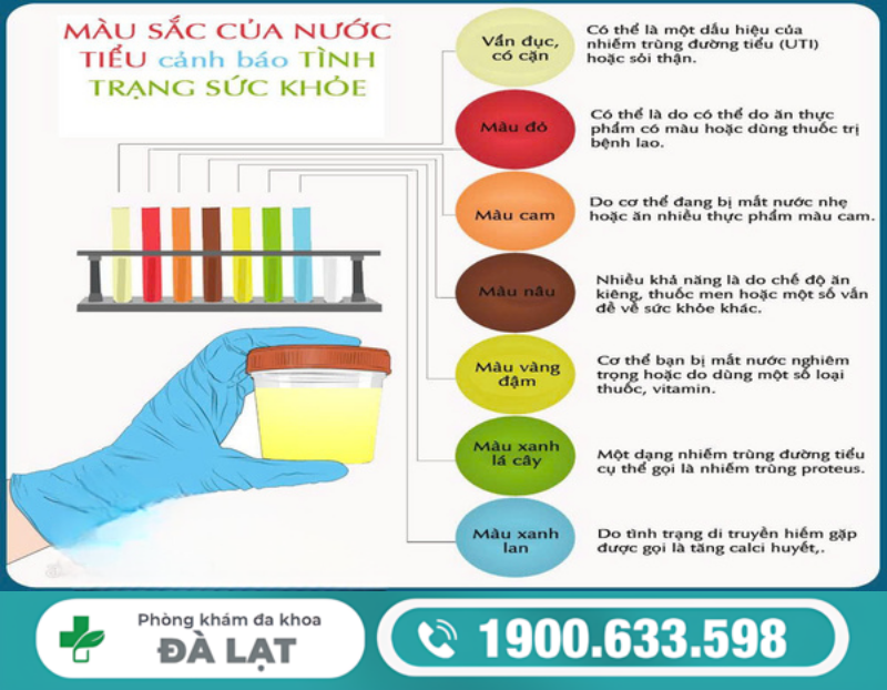 NƯỚC TIỂU MÀU XANH Ở NỮ LÀ GÌ? DẤU HIỆU CẢNH BÁO BỆNH LÝ NGUY HIỂM 