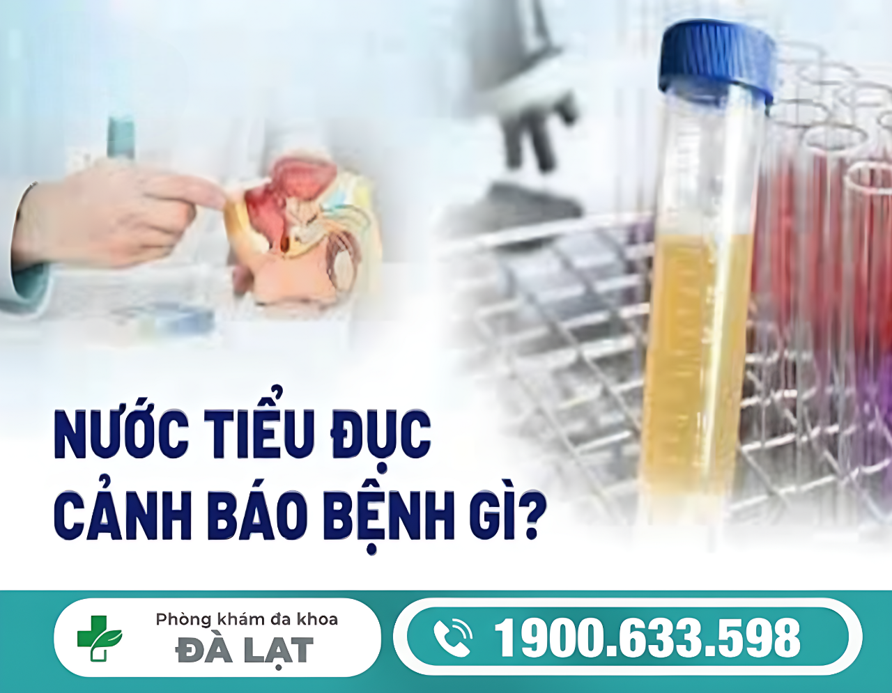 NƯỚC TIỂU MÀU TRẮNG ĐỤC Ở NỮ LÀ BỆNH GÌ? CẢNH BÁO BIẾN CHỨNG NGUY HIỂM