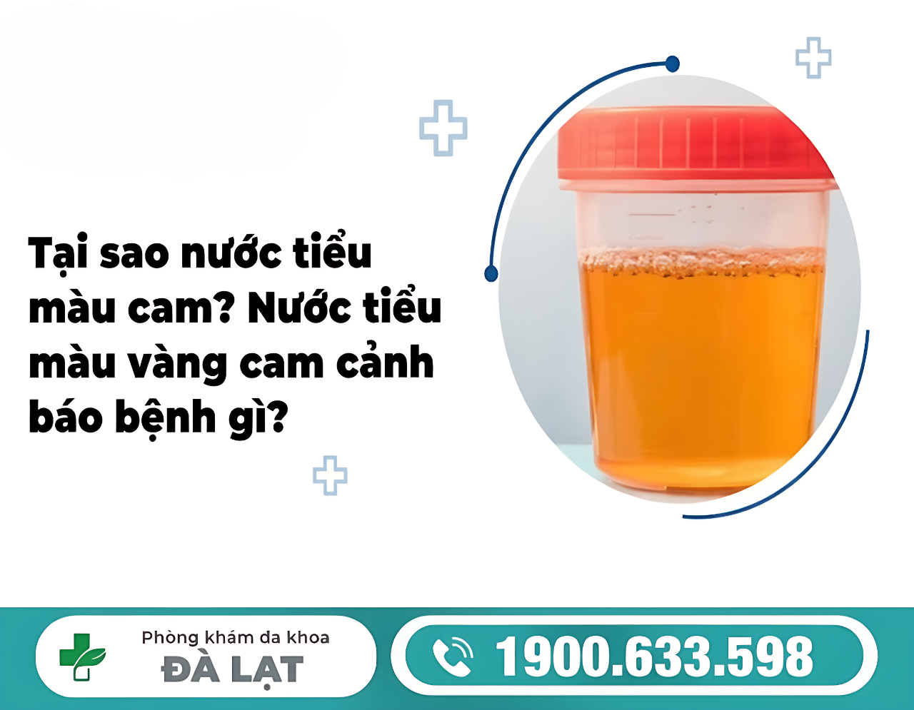 NƯỚC TIỂU MÀU CAM ĐẬM Ở NAM LÀ GÌ? CẢNH BÁO BỆNH LÝ NGUY HIỂM