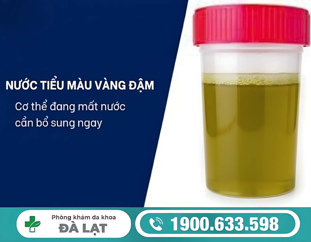 NƯỚC TIỂU MÀU VÀNG ĐẬM Ở NAM GIỚI: NGUYÊN NHÂN VÀ CÁCH ĐIỀU TRỊ HIỆU QUẢ