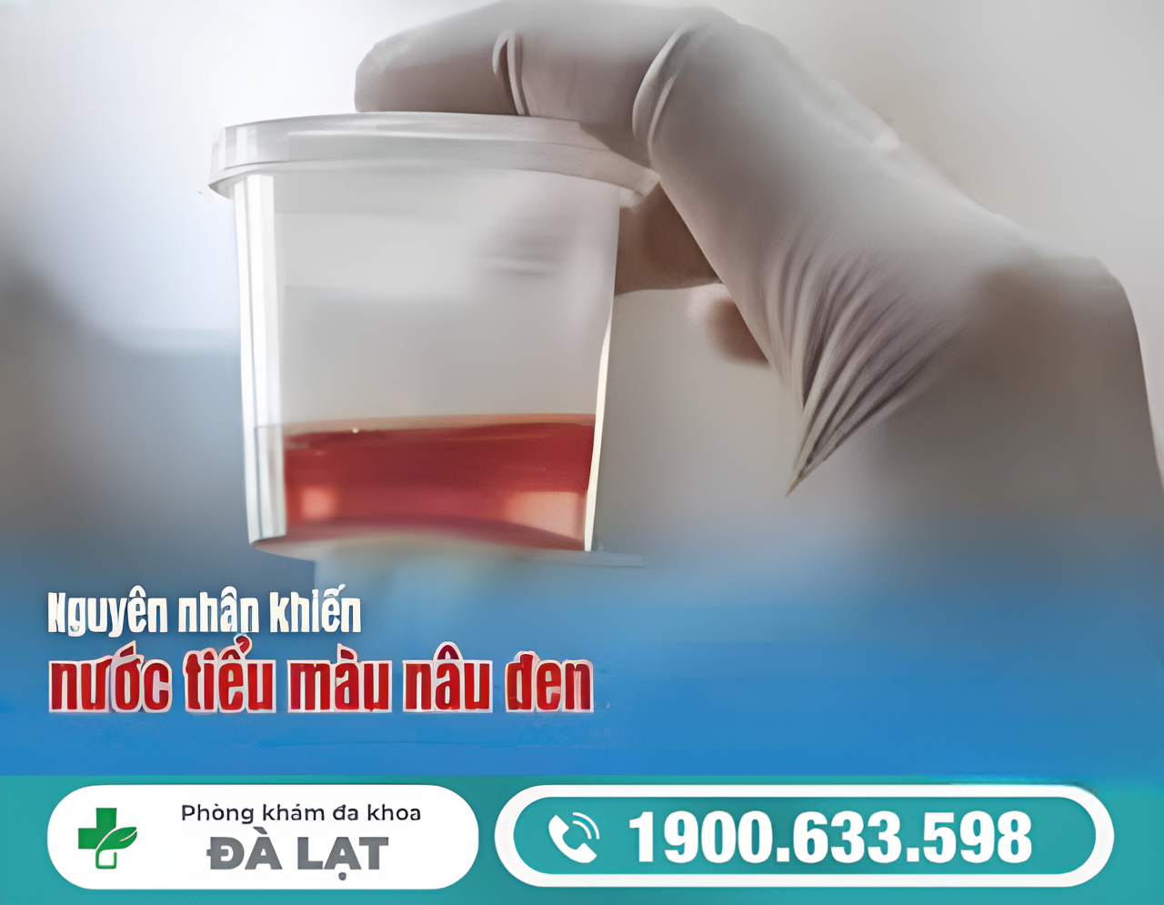 NƯỚC TIỂU MÀU NÂU ĐEN Ở NAM GIỚI: NGUYÊN NHÂN VÀ CÁCH ĐIỀU TRỊ HIỆU QUẢ 