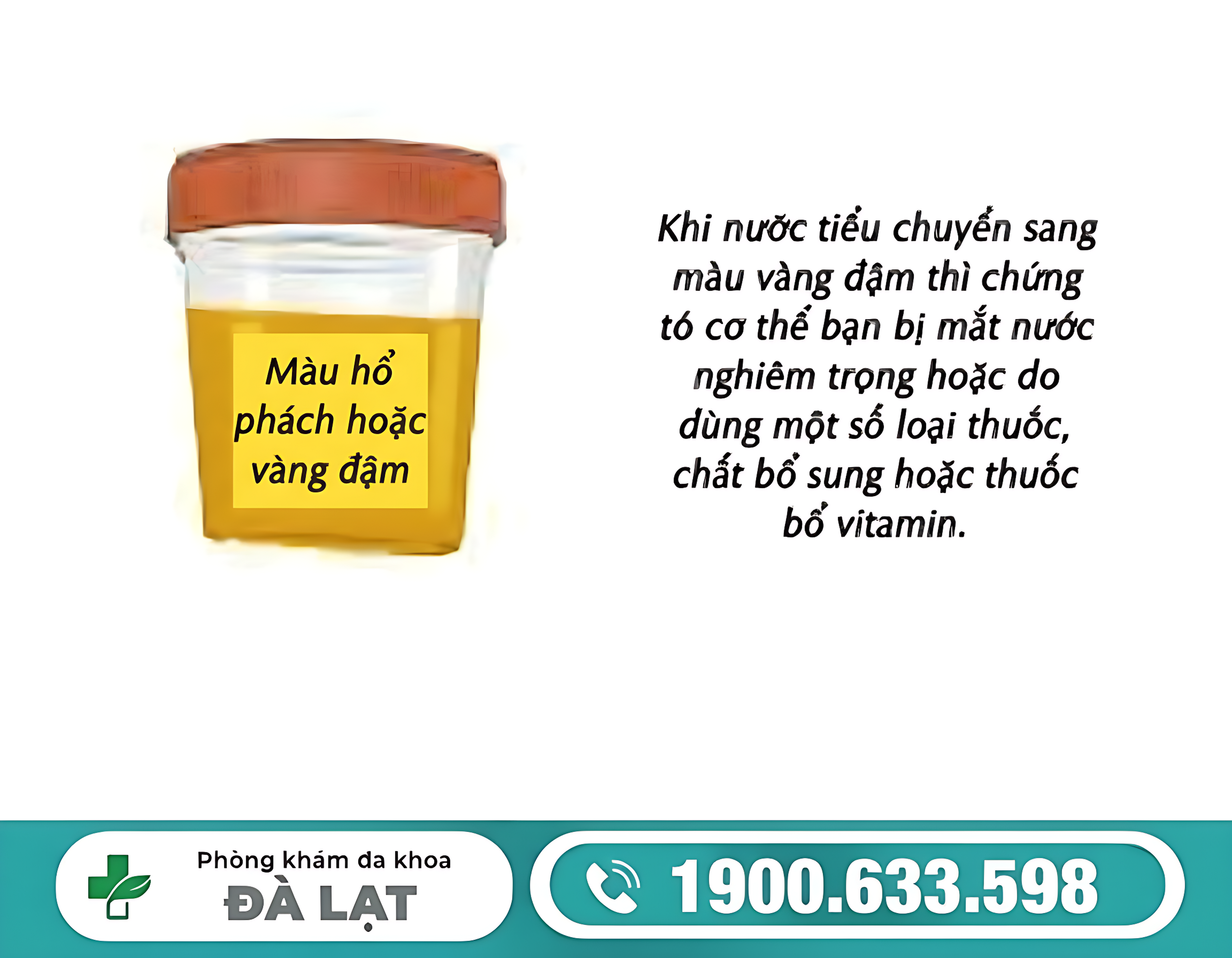 ĐI TIỂU CÓ MÀU VÀNG ĐẬM Ở NAM VÀ NỮ LÀ BỆNH GÌ? NGUYÊN NHÂN VÀ CÁCH ĐIỀU TRỊ HIỆU QUẢ 