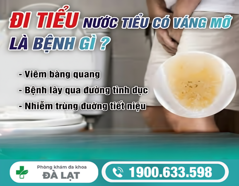 CÁC BỆNH LÝ KHI ĐI TIỂU CÓ VÁNG MỠ Ở NAM VÀ NỮ 