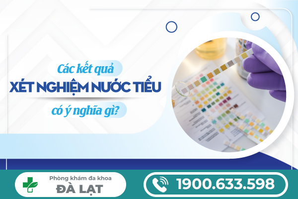 NHỮNG BỆNH LÝ NGUY HIỂM ĐƯỢC PHÁT HIỆN QUA XÉT NGHIỆM NƯỚC TIỂU