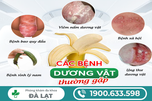 ĐẦU KHẤC BỊ MẦN ĐỎ Ở NAM GIỚI: KHI NÀO CẦN ĐI KHÁM?