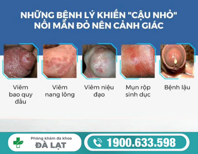 KHI NÀO NAM GIỚI NÊN ĐI KHÁM NẾU ĐẦU KHẤC BỊ KHÔ, NGỨA,ĐAU RÁT VÀ CÓ MÙI HÔI 