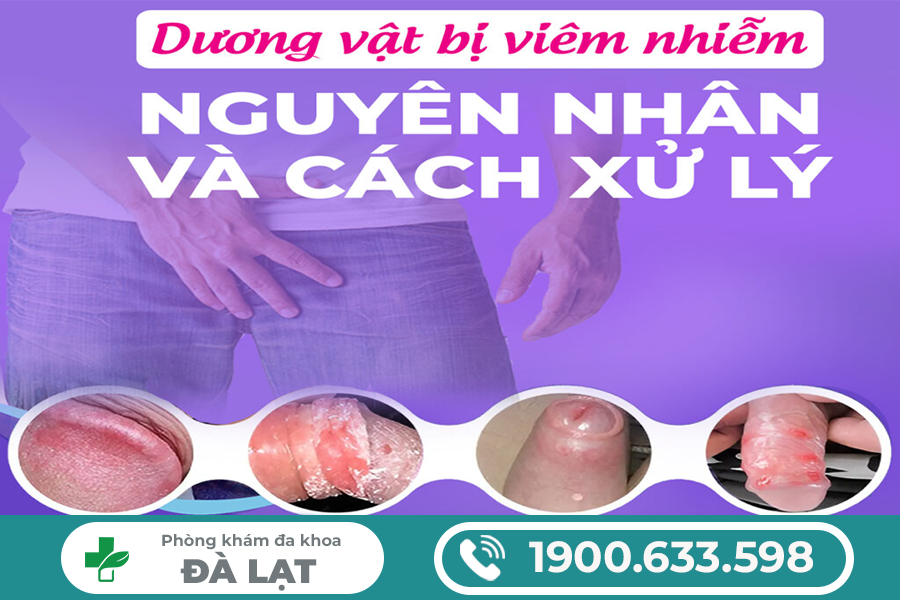 NAM GIỚI BỊ VIÊM NHIỄM ĐẦU KHẤC: NGUYÊN NHÂN VÀ CÁCH ĐIỀU TRỊ HIỆU QUẢ