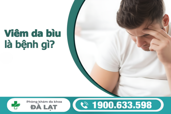 ĐAU RÁT BÌU Ở NAM GIỚI CẢNH BÁO BỆNH GÌ? DẤU HIỆU KHÔNG NÊN BỎ QUA