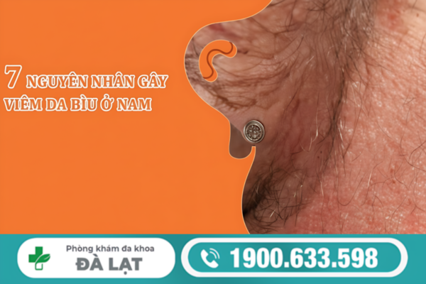 ĐAU BÌU MỘT BÊN Ở NAM GIỚI: NGUYÊN NHÂN VÀ CÁCH ĐIỀU TRỊ 