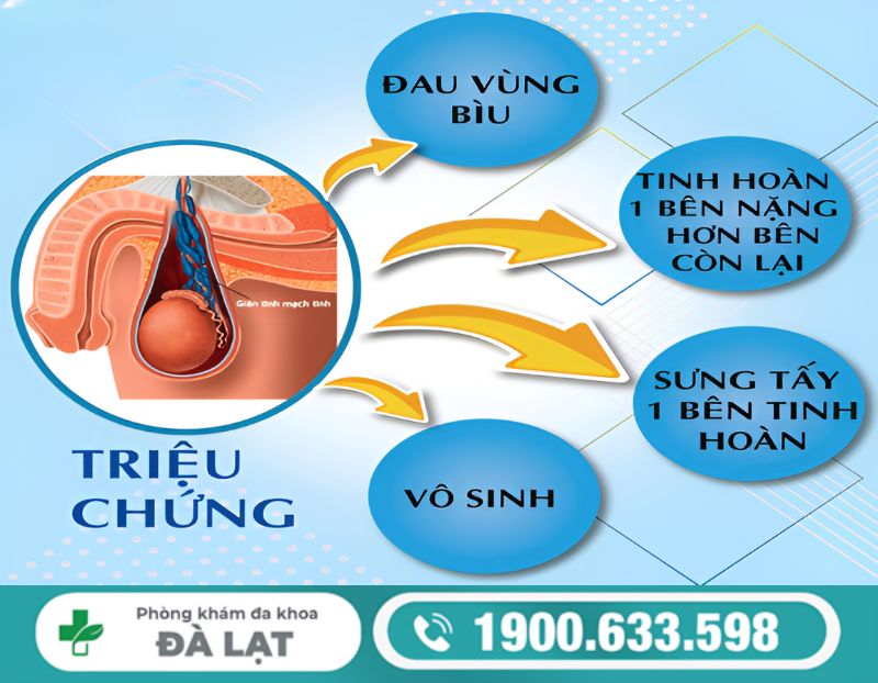 VIÊM BÌU Ở NAM GIỚI LÀ GÌ? NGUYÊN NHÂN VÀ CÁCH ĐIỀU TRỊ HIỆU QUẢ 